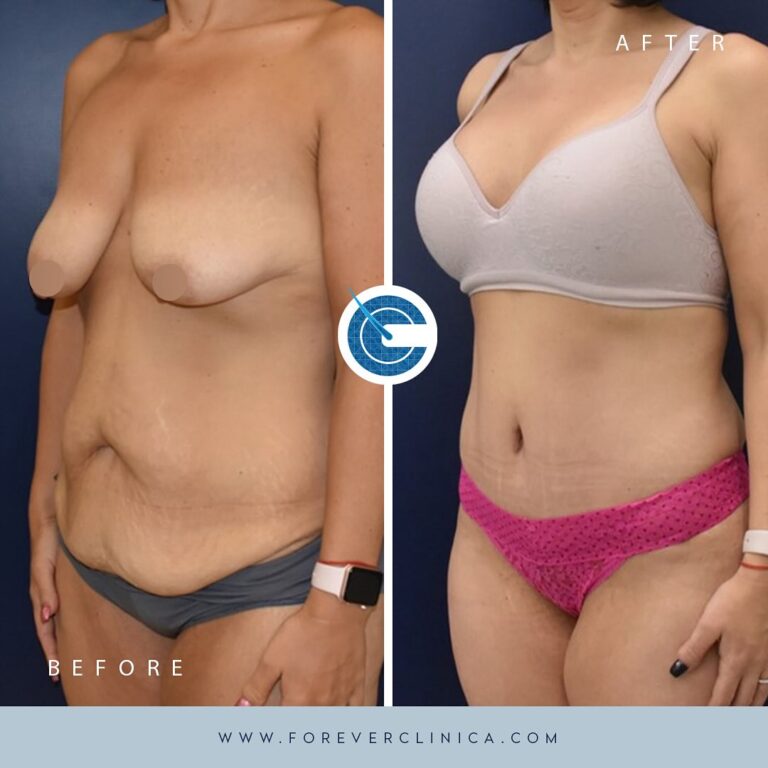 427948889_17942073821789208_4750722810648059911_n