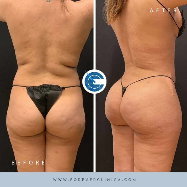 430101831_17944338047789208_2309046048055358598_n