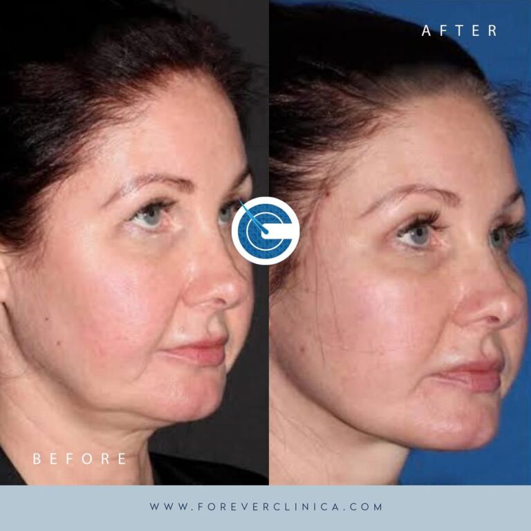 436299043_17950146014789208_4992130879630656377_n