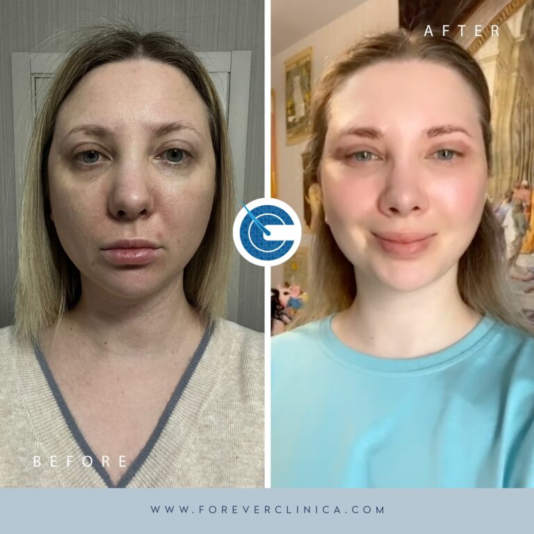 442419308_17954123819789208_8929090017312971486_n