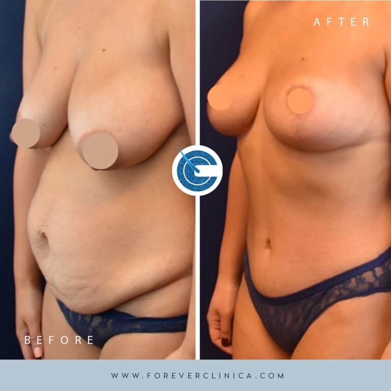 448238093_17956914647789208_2959319014371776604_n