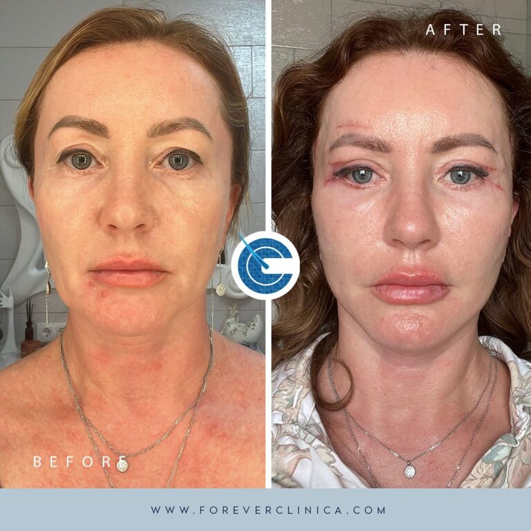 448695697_17957937764789208_5049935714829512573_n