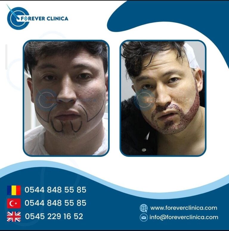 WhatsApp Image 2025-11-25 at 10.03.54